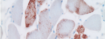 MRNA SPIKE PROTIENS IN BROWN
