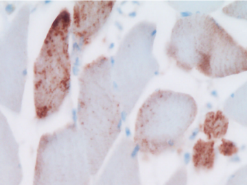 MRNA SPIKE PROTIENS IN BROWN
